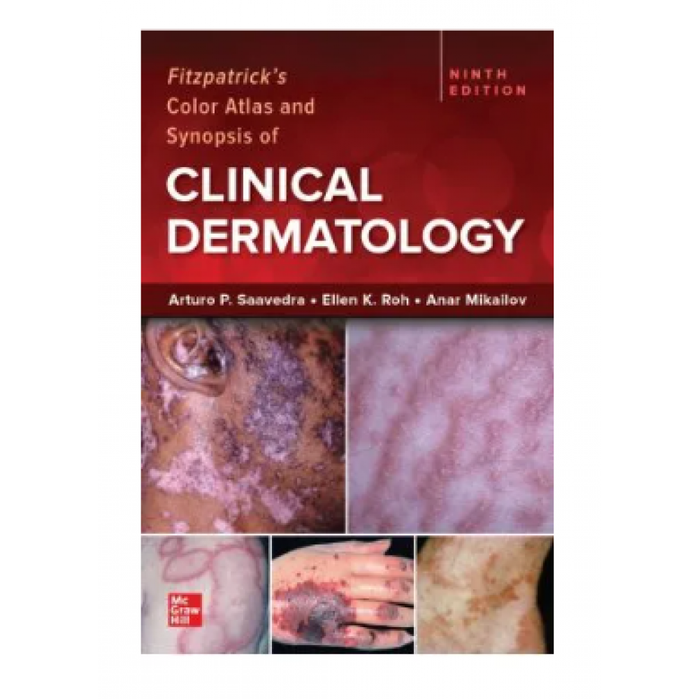 Fitzpatrick S Color Atlas And Synopsis Of Clinical Dermatology Th